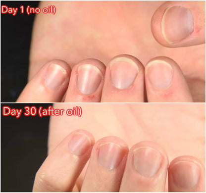 Ulei - Nail oil